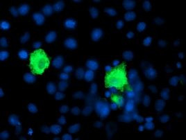 SHPK Antibody in Immunocytochemistry (ICC/IF)