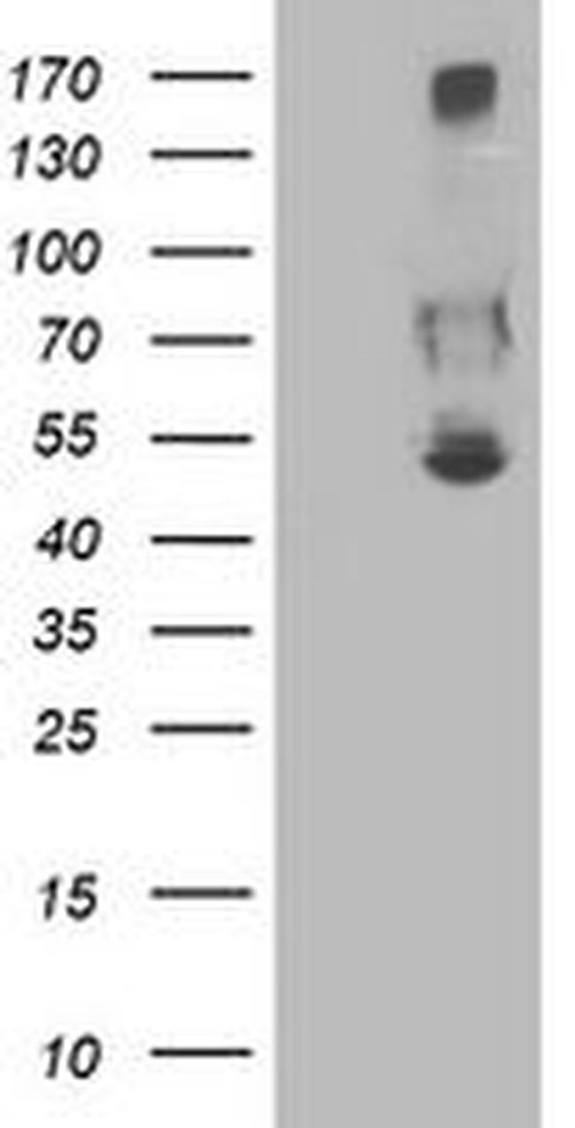 SHPK Antibody in Western Blot (WB)