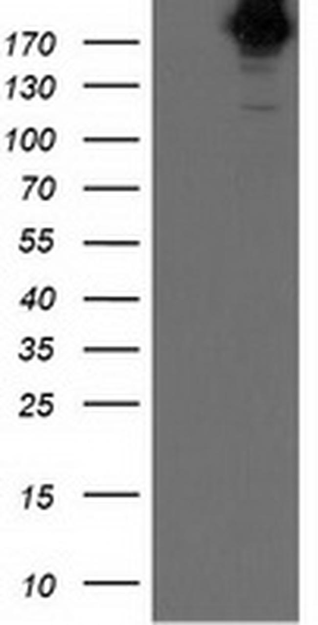 SHPRH Antibody in Western Blot (WB)