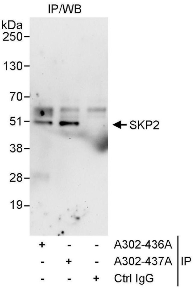 SKP2 Antibody in Immunoprecipitation (IP)