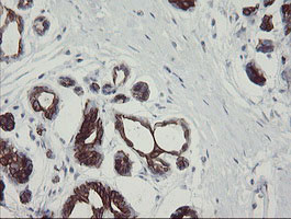 SLA2 Antibody in Immunohistochemistry (Paraffin) (IHC (P))