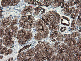 SLA2 Antibody in Immunohistochemistry (Paraffin) (IHC (P))