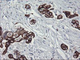 SLA2 Antibody in Immunohistochemistry (Paraffin) (IHC (P))