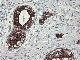 SLA2 Antibody in Immunohistochemistry (Paraffin) (IHC (P))