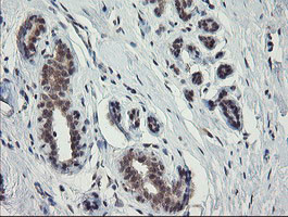 SLA2 Antibody in Immunohistochemistry (Paraffin) (IHC (P))