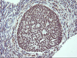 SLA2 Antibody in Immunohistochemistry (Paraffin) (IHC (P))