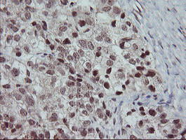 SLA2 Antibody in Immunohistochemistry (Paraffin) (IHC (P))