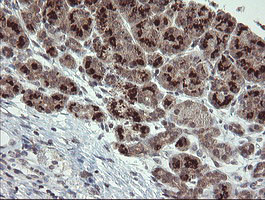 SLA2 Antibody in Immunohistochemistry (Paraffin) (IHC (P))