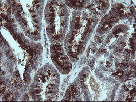 SLA2 Antibody in Immunohistochemistry (Paraffin) (IHC (P))