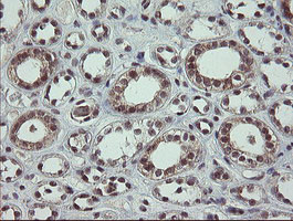 SLA2 Antibody in Immunohistochemistry (Paraffin) (IHC (P))