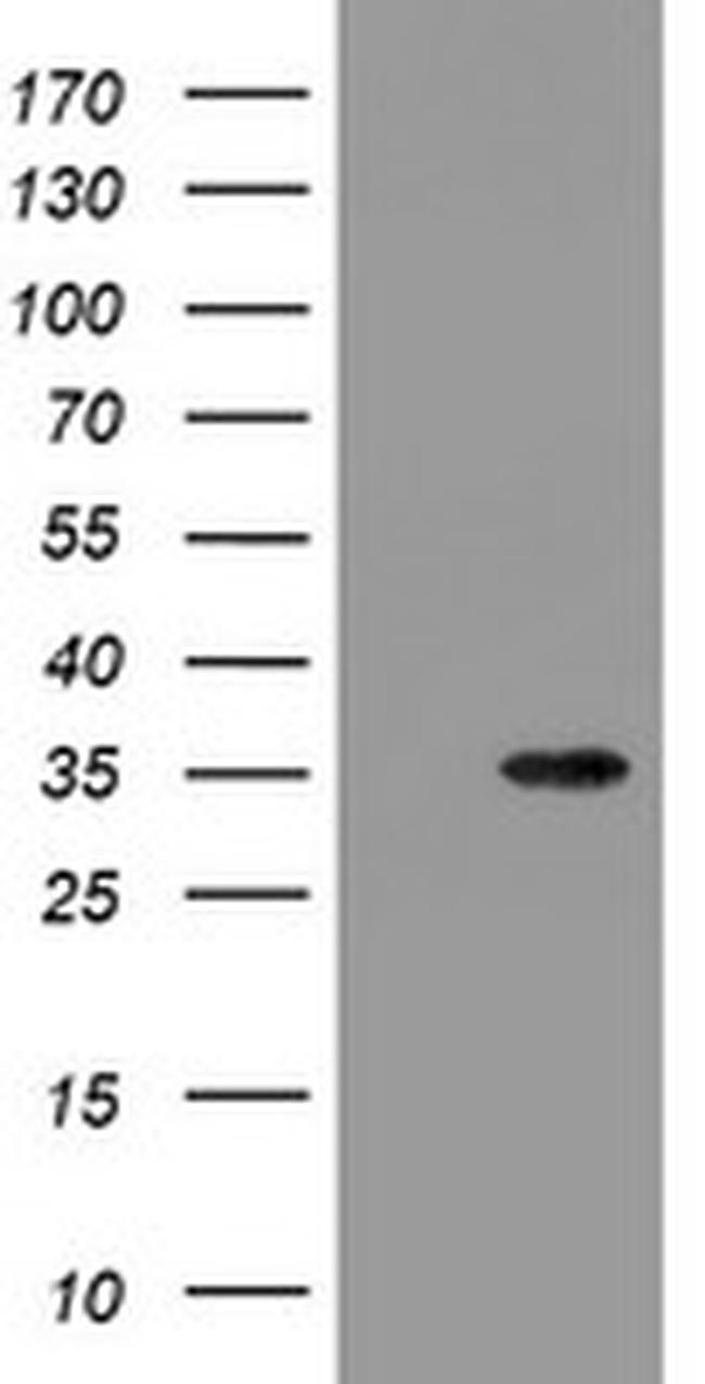 SLA2 Antibody in Western Blot (WB)