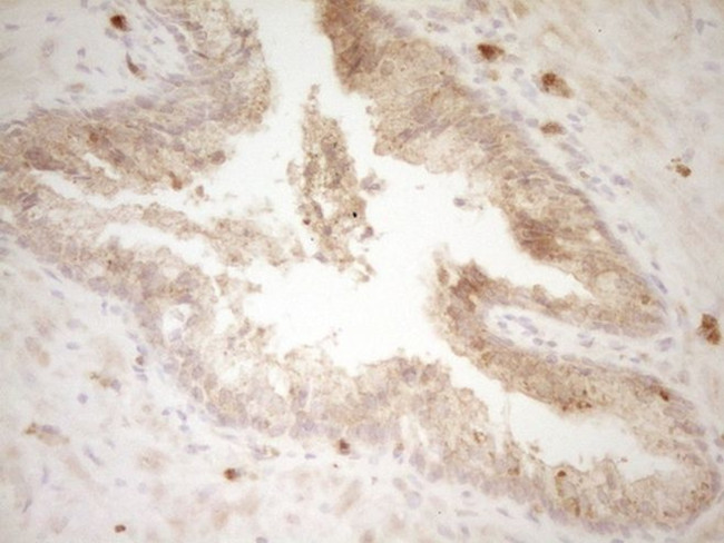 SLAMF7 Antibody in Immunohistochemistry (Paraffin) (IHC (P))