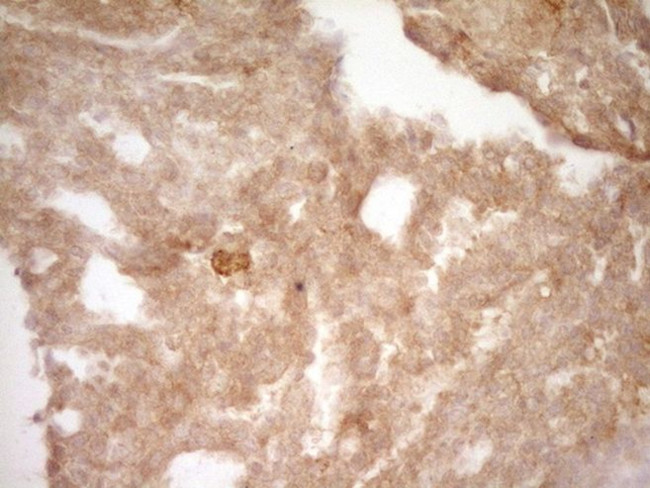 SLAMF7 Antibody in Immunohistochemistry (Paraffin) (IHC (P))