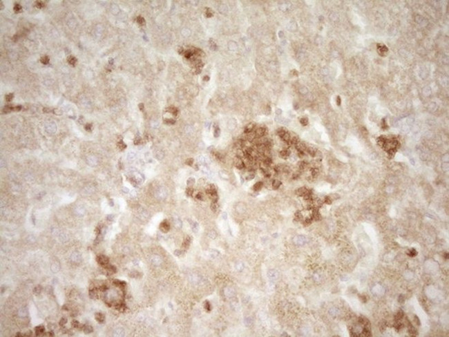 SLAMF7 Antibody in Immunohistochemistry (Paraffin) (IHC (P))