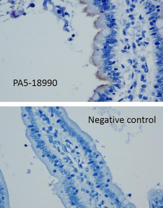 SLC10A2 Antibody in Immunohistochemistry (Paraffin) (IHC (P))