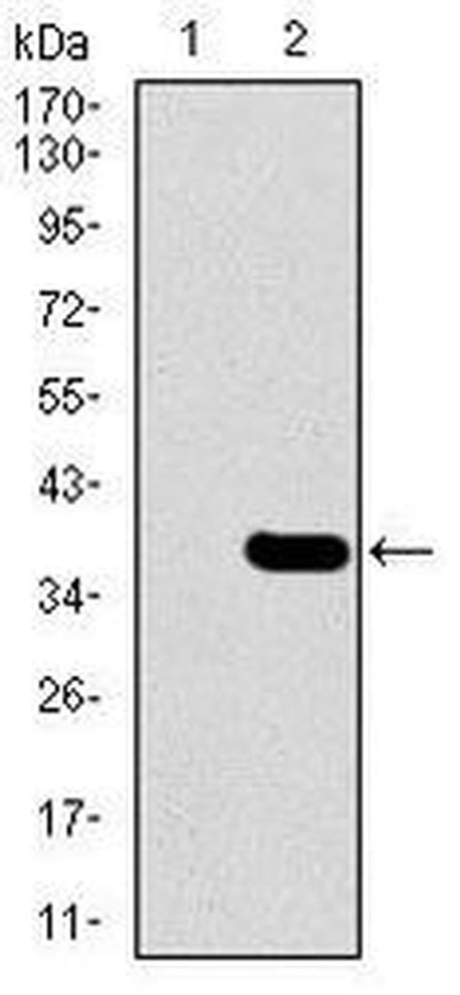 SLC27A5 Monoclonal Antibody (4B11C10) (MA5-17175)