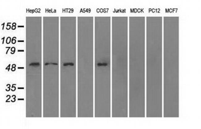 SLC2A5 Antibody in Western Blot (WB)