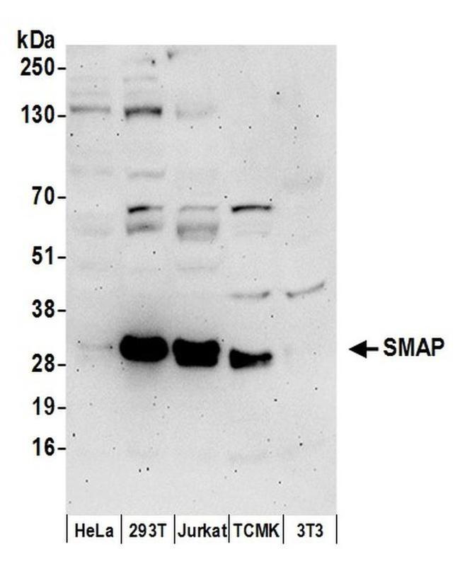 SMAP Antibody in Western Blot (WB)