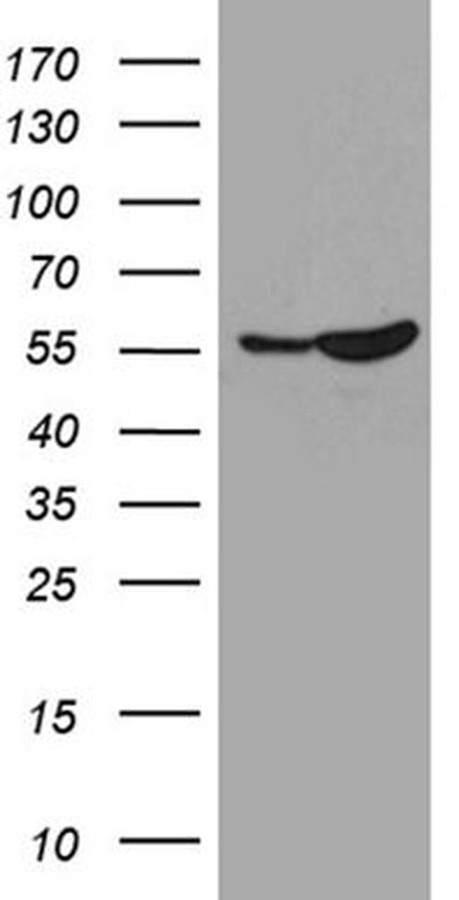 SMARCD3 Antibody in Western Blot (WB)