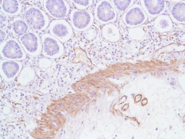 Alpha-Smooth Muscle Actin Antibody in Immunohistochemistry (IHC)