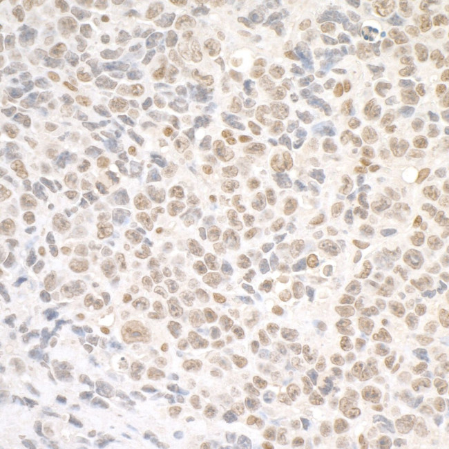 SMC1 Antibody in Immunohistochemistry (IHC)