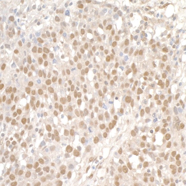 SMC1 Antibody in Immunohistochemistry (IHC)