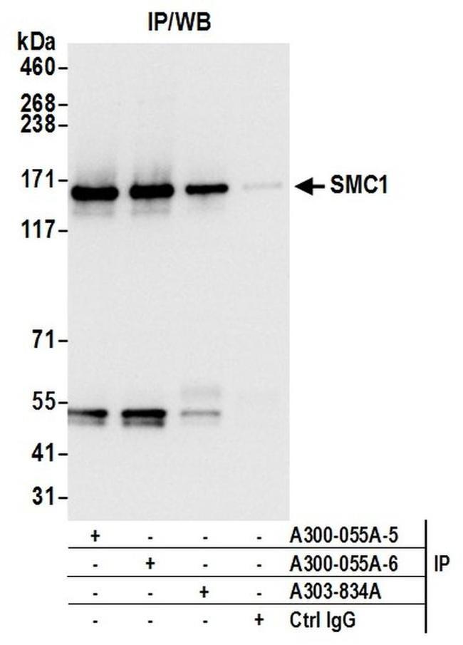 SMC1 Antibody in Western Blot (WB)