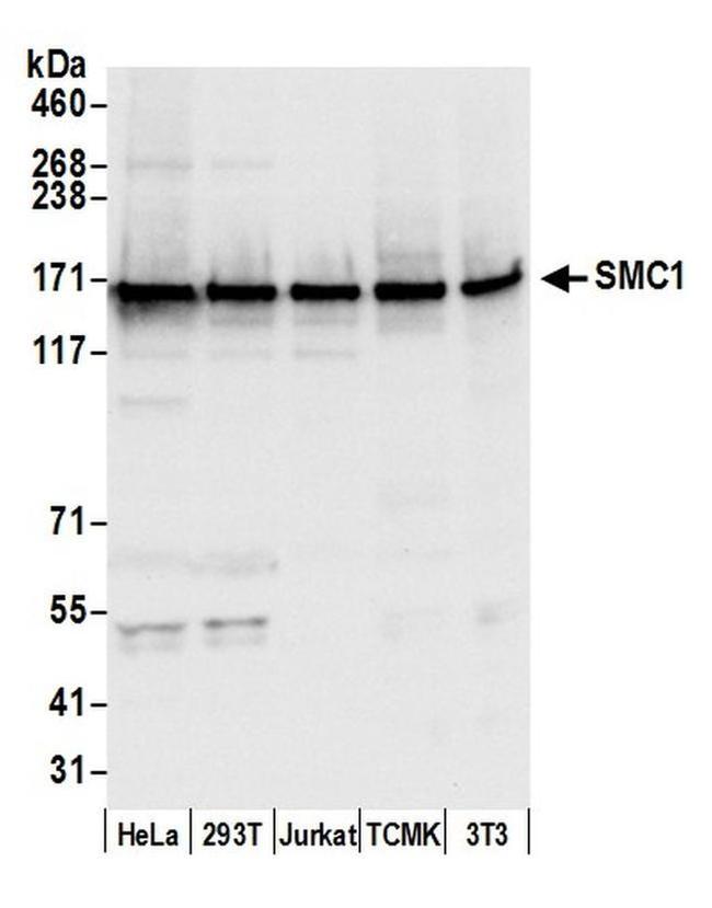 SMC1 Antibody in Western Blot (WB)