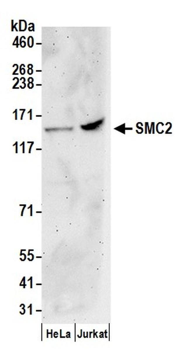SMC2 Antibody in Western Blot (WB)