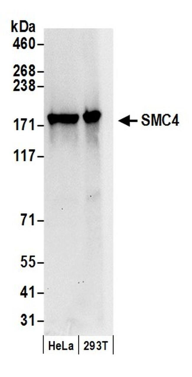 SMC4 Antibody in Western Blot (WB)