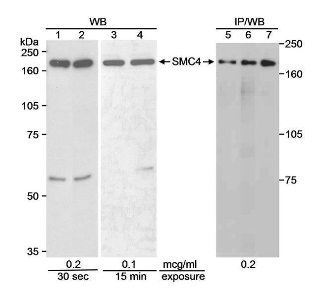 SMC4 Antibody in Western Blot (WB)