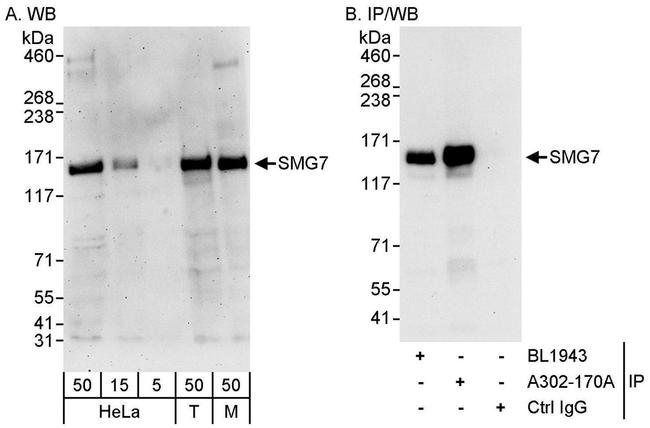 SMG7 Antibody in Western Blot (WB)