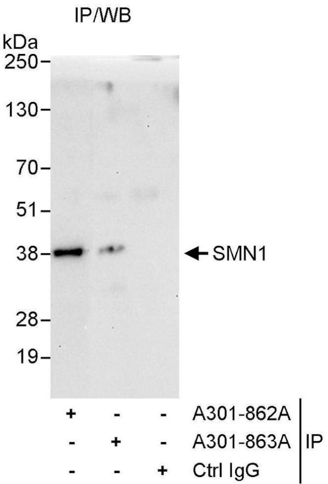 SMN1 Antibody in Immunoprecipitation (IP)