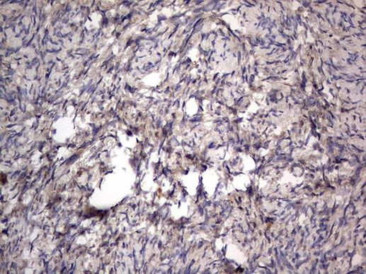 SMPD1 Antibody in Immunohistochemistry (Paraffin) (IHC (P))