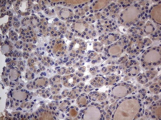 SMPD1 Antibody in Immunohistochemistry (Paraffin) (IHC (P))