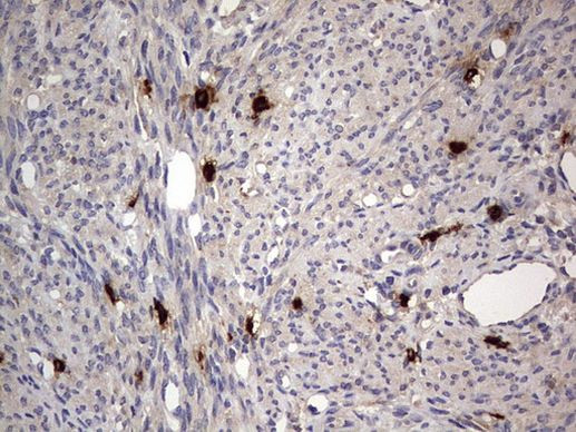 SMPD1 Antibody in Immunohistochemistry (Paraffin) (IHC (P))