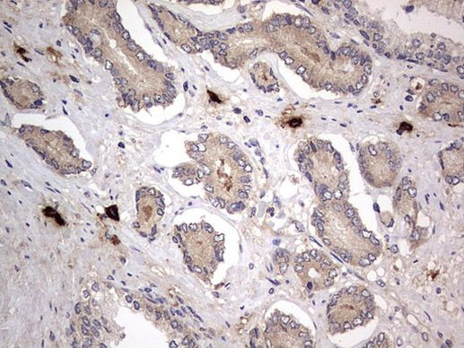 SMPD1 Antibody in Immunohistochemistry (Paraffin) (IHC (P))