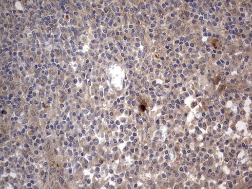 SMPD1 Antibody in Immunohistochemistry (Paraffin) (IHC (P))