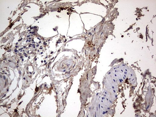 SMPD1 Antibody in Immunohistochemistry (Paraffin) (IHC (P))