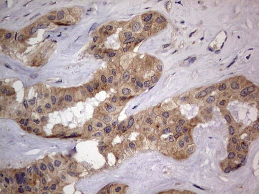 SMPD1 Antibody in Immunohistochemistry (Paraffin) (IHC (P))