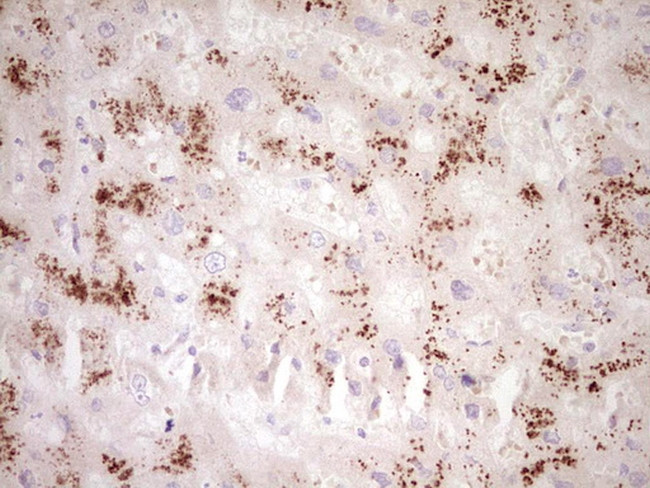 SMURF2 Antibody in Immunohistochemistry (Paraffin) (IHC (P))