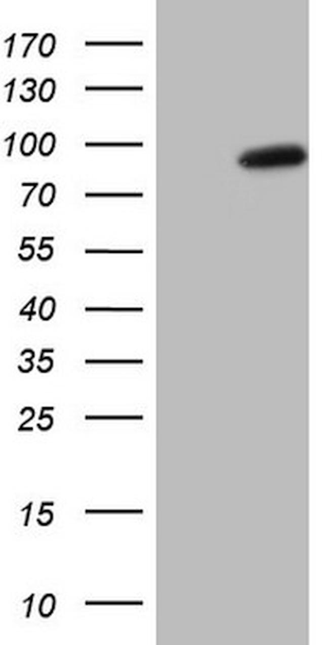 SMURF2 Antibody in Western Blot (WB)