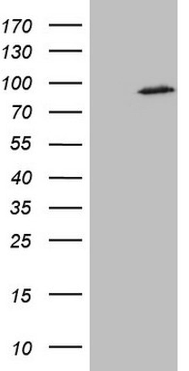 SMURF2 Antibody in Western Blot (WB)