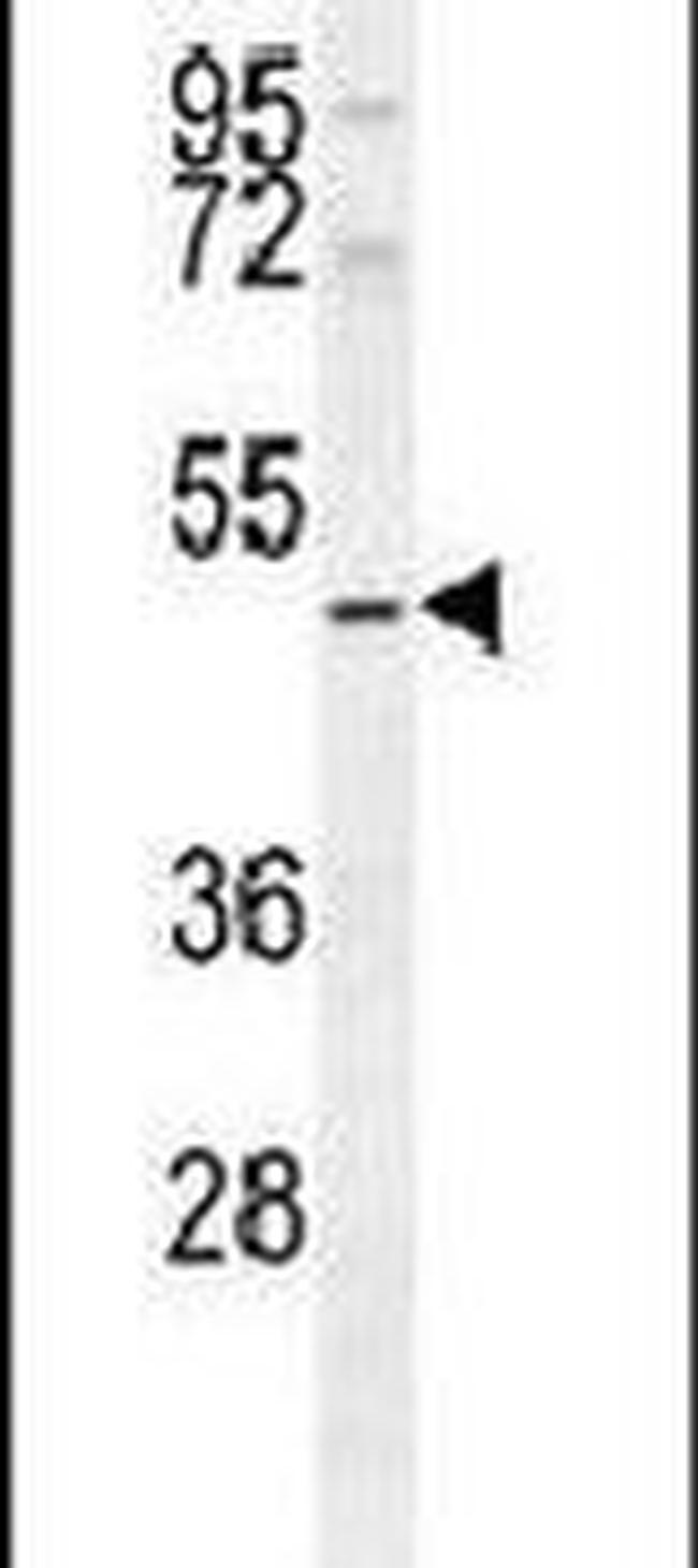 SMYD1 Antibody in Western Blot (WB)