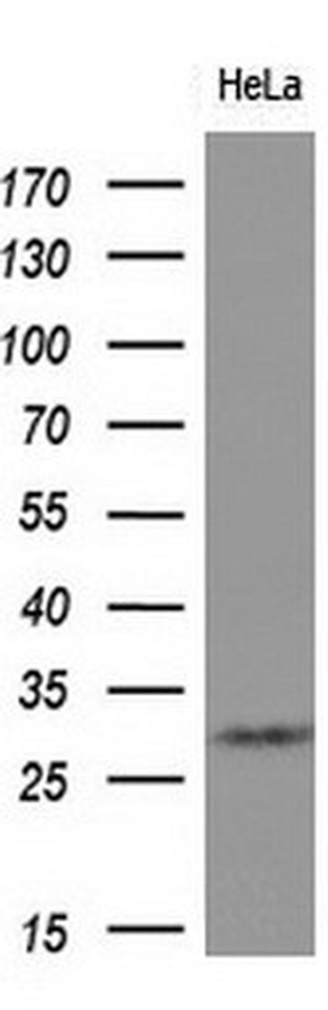 SNAI1 Antibody in Western Blot (WB)