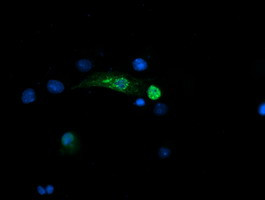 SNAI2 Antibody in Immunocytochemistry (ICC/IF)