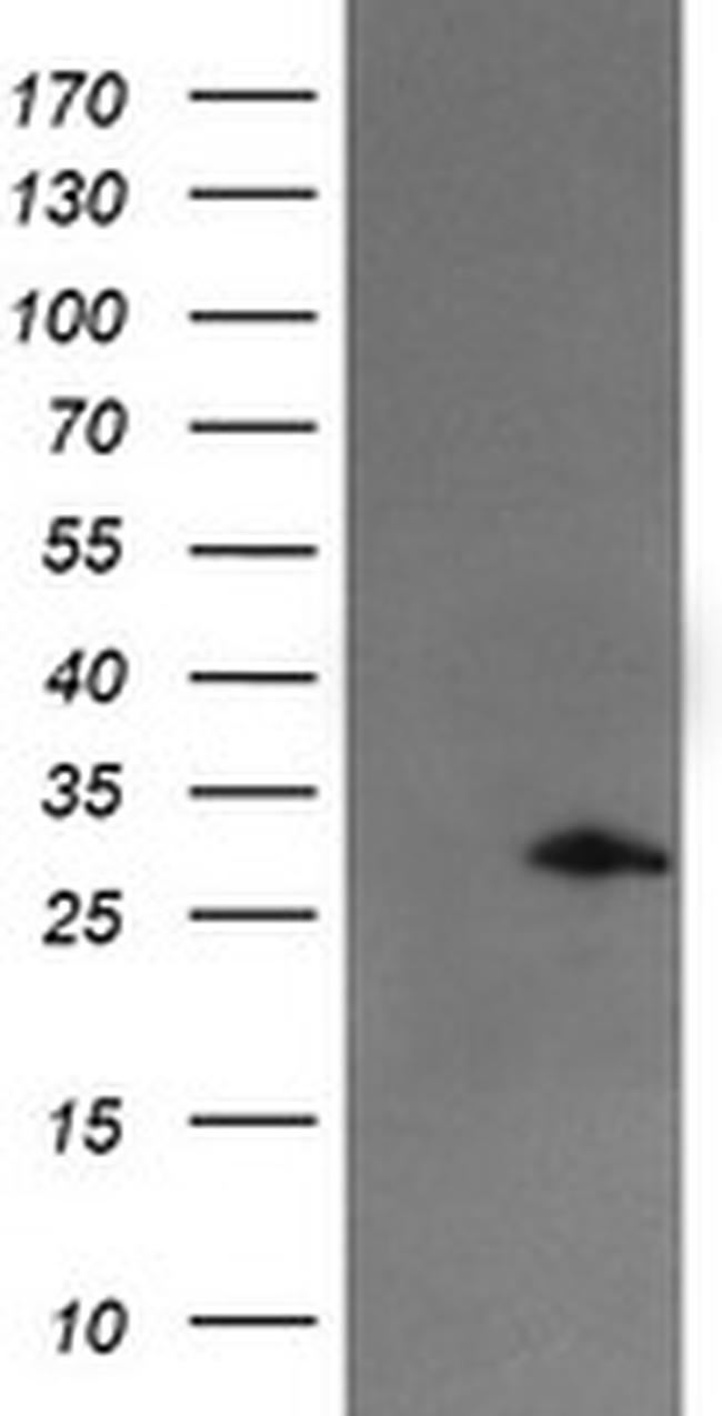 SNAI2 Antibody in Western Blot (WB)