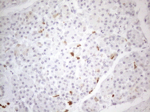 SNRPB2 Antibody in Immunohistochemistry (Paraffin) (IHC (P))