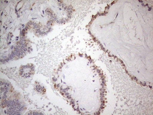 SNRPB2 Antibody in Immunohistochemistry (Paraffin) (IHC (P))