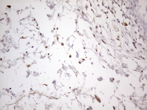 SNRPB2 Antibody in Immunohistochemistry (Paraffin) (IHC (P))